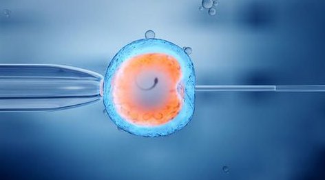 试管婴儿促排前什么人不需降调