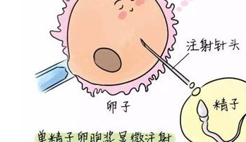 移植冻胚十二天测试是白板成功率低