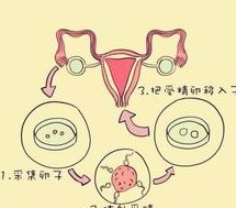 福建省妇幼保健院试管婴儿费用多少